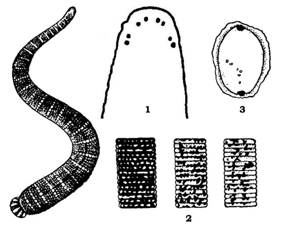    (Herpobdella octoculata):  ,    (1),     (2)   (3)
